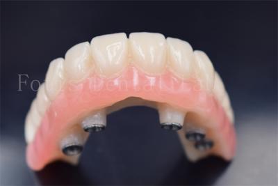 China Implantes dentários personalizados Coroas de substituição Resistência ao desgaste à venda
