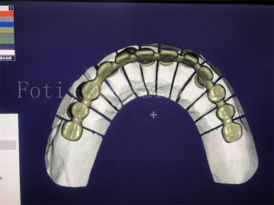 China Reliable Effective Dental Design Service Superior And Competitive for sale