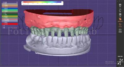 China OEM Mouth Models Maker Dental Design Service With Tooth Blueprint Builder for sale