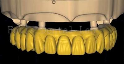 中国 歯科王冠設計は 先進的なスキャンと3Dプリンティング技術を使用します 販売のため