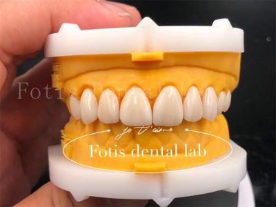 China Coronas dentales digitales rápidas y eficientes tamaño personalización de la corona de implantes dentales en venta
