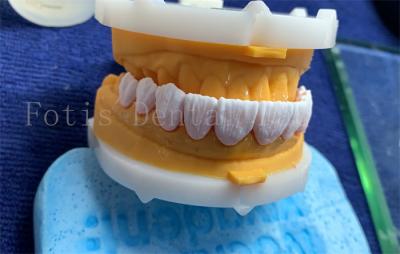 Китай Усовершенствованные цифровые зубные короны имплантат зубной короны FDA/ISO/CE сертифицированные продается