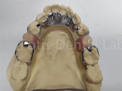 China Adjustable Co Cr Partial Denture Comfortable Dental Prosthesis For Missing Teeth for sale