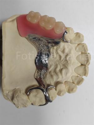 China Durable Odor Resistant Removable Partial Denture Highly Adjustable for sale