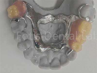 China FDA Easy To Clean Removable Partial Denture Compatible With Natural Teeth for sale