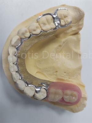 China Replace Missing Teeth Removable Partial Denture Dental Prosthesis Flexible Design for sale