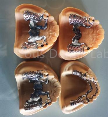 China Flexible Removable Partial Denture With Long Lasting Stability And Adjustable Comfort for sale