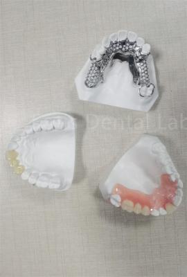 China Dentadura parcial removible y flexible de larga duración, fácil limpieza, reemplaza los dientes perdidos en venta