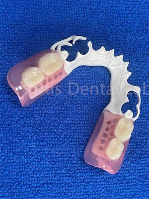 中国 調節可能 柔軟性のある 歯科 義歯 安定した 快適 すぐれた 部分 義歯 販売のため