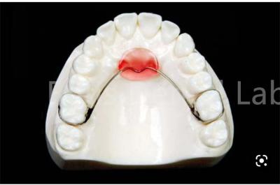 中国 調整可能な口拡張保持器 安全な歯の保持と拡張のために 販売のため