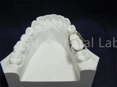 Chine Retenant réglable Expandant Solution orthodontique pratique Entretien facile à vendre