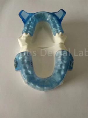 Chine Appareil d'orthodontie avancé pour des résultats d'alignement des dents supérieurs à vendre