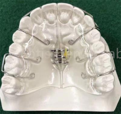 中国 最先端の矯正歯科器具 拡張保持器 調整可能 販売のため