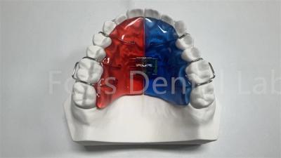 中国 歯 の 矯正 と 改善 に おける 個別 的 な 矯正 器 販売のため