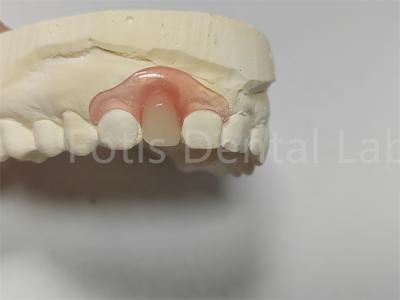 China Parciais dentárias flexíveis de Valspar Rosa / Transparente Facil ajuste à venda