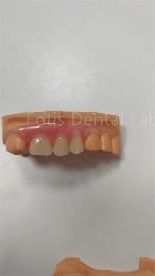 China Durable TCS Flexible Partial Valplast Flexible Dentures Stain Resistant for sale