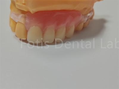 China FDA/ISO Certificação TCS Valplast Dentes flexíveis Fácil de limpar Ajustar à venda