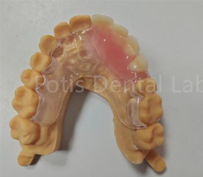 China Hypoallergenic Comfort Fit Flexible Valplast Partial TCS Dental Appliance for sale