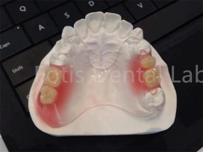 China TCS flexível Valplast aparelhos dentários Confortável Design durável à venda