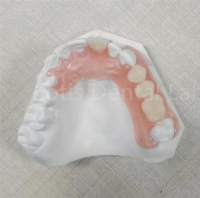 中国 ピンク色/透明型 TCS バルプラスト 臭いを阻む柔軟な歯の義肢 販売のため