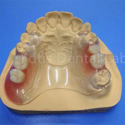 China Fácil de limpiar y ajustar Prótesis dental parcial Durable Confortable en venta