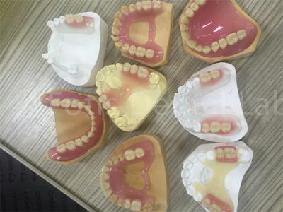 中国 柔軟なTCS バルプラスト 取れる部分歯入れ 調節が簡単 販売のため