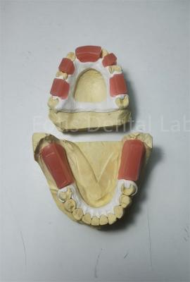 Chine La cire dentaire est utilisée pour la fixation de la taille des dents. à vendre