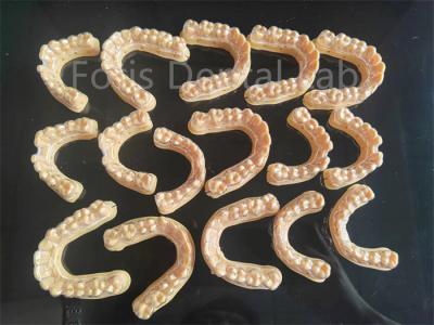 China Convenient Invisible Dental Aligners Customizable Easy To Clean for sale