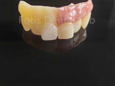 China Monolithic Zirconia Layered With Porcelain Computer Aided Design for sale