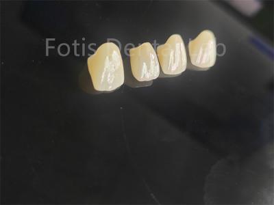 中国 プロフェッショナル グレード の 陶器 溶融 ジルコニア 歯 の 修復 に ぴったり に 合わせる 販売のため