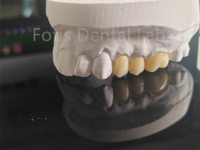 China High Strength  Full Porcelain Layered Zirconia For Dental Crowns for sale