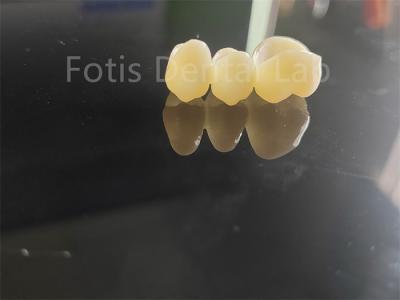 China Dental Industry Zirconia Layered With Porcelain Long Lasting Solution for sale