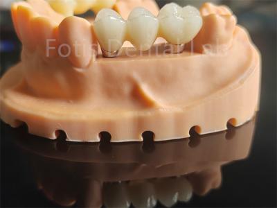 China Material cerámico basado en zirconio de alta dureza para aplicaciones dentales en venta