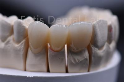 China Customizable Thickness Multilayer Zirconia Ceramic Dental Material for sale