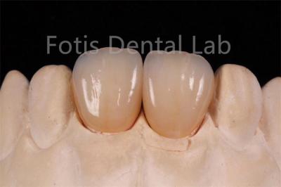 中国 高透明性多層ジルコニア 歯科修復の製造用 販売のため