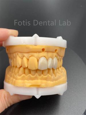 Chine Céramique dentaire en zirconium multicouche de haute durabilité pour produit médical de laboratoire dentaire à vendre
