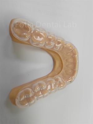 China Ergonomic Hard Soft Occlusal Guard Soft Teeth Guard  Long Term Use for sale