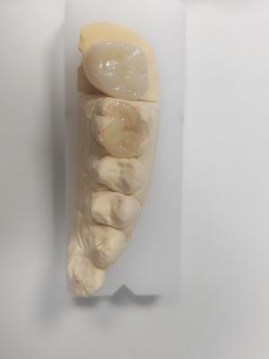 China Incrustación y incrustación dental para el relleno indirecto y la restauración del color de los dientes en venta