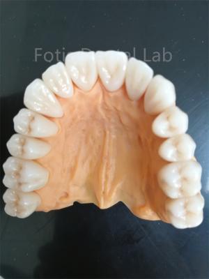 China Advanced Multi Layered Zirconia For Superior Wear And Corrosion Resistance for sale