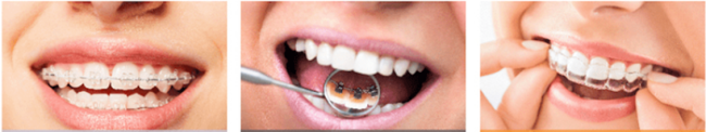 Orthodontic Bonding System product characteristics diagram