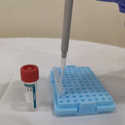 China Nasal Flocked Swab Viral Preservation Reagent Sample Release in 5 Seconds without Extraction Direct PCR for sale