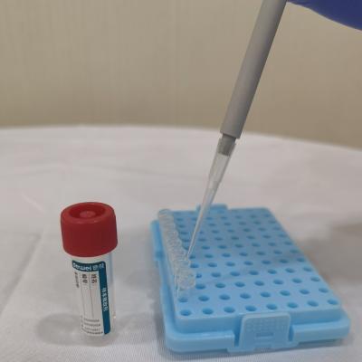 China Tubo de la preservación y de la extracción del ARN de Kit Flocked Swab del lanzamiento de la muestra directamente en la amplificación de la polimerización en cadena en venta