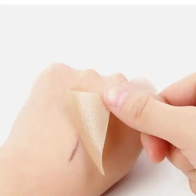 China Silikon-Narbenschichten, -Band, -Streifen -Heilende Keloide, Kaiserschnitt, Bauchbehandlung - Behandlung von chirurgischen Narben zu verkaufen