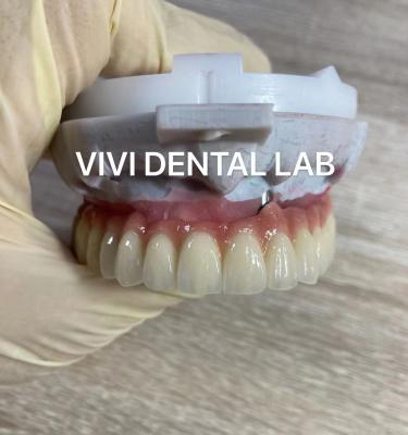 Chine Scheftner Ivoclar Porcelaine des couronnes métalliques fondues technique SLM dentaire à vendre
