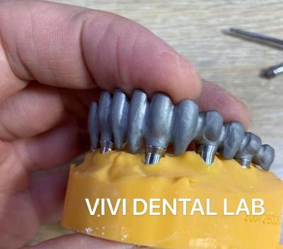 China Imprimido PFM Puente Dental Biocompatible sobre Abutments de Multi Unidad en venta