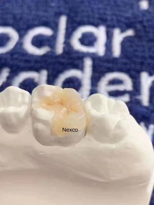 Chine Les incrustations et les incrustations composites dentaires Ivoclar Nexco haute esthétique à vendre