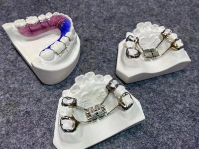 Китай Ортодонтические зубы Палатный экспандер Стабильное пространство Зубной арки экспандер продается