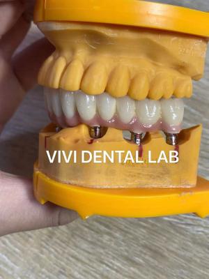 China Full Jaw Dental Implant Crown Metal Printed Digital Tooth Supported Bridge for sale