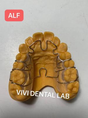China Removable Teeth Alignment Correction ALF Alternative Lightwire Functional for sale