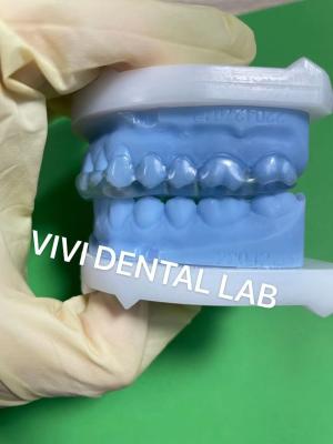 China Dental estável Michigan tipo talas Semi-duro / duro Perfeito ajuste à venda